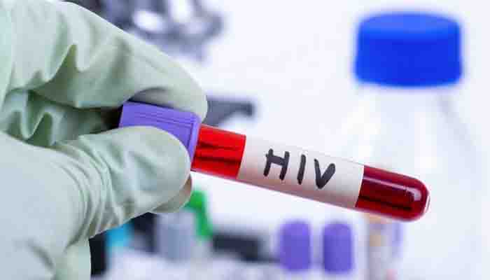 Pemprov Bengkulu Tekan Penyebaran HIV/AIDS