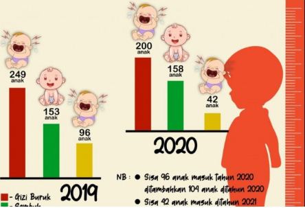 Balita di Pagar Gading Alami Gizi Buruk