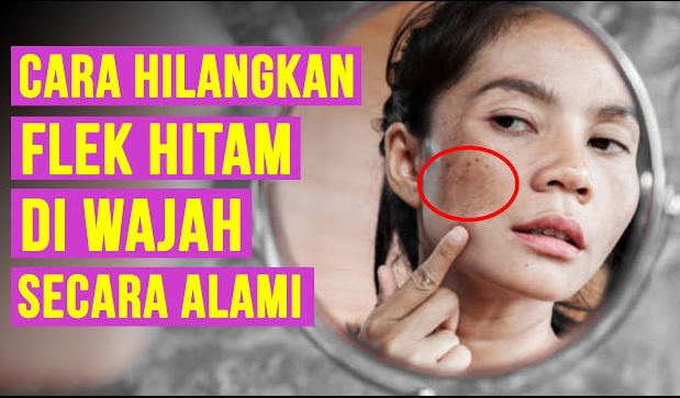 Cara Menghilangkan Bintik Hitam di Wajah Secara Alami, Tak Perlu Mahal, Begini Cara Buat dan Bahannya