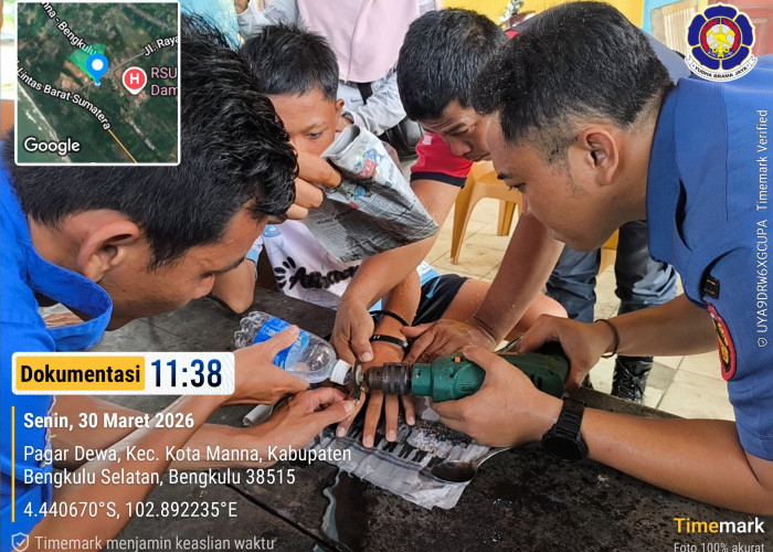 Cincin Tersangkut di Jari Anak, Damkar Bengkulu Selatan Lakukan Evakuasi Cepat dan Aman