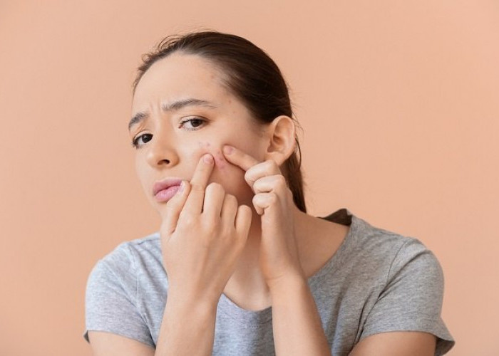 Dokter Kulit: Jerawat di Hidung Tidak Boleh Dipencet! Ini Alasannya 