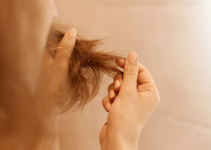 Kesehatan Usus yang Buruk Picu Kerontokan Rambut